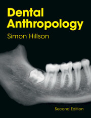 Dental Anthropology Dental Anthropology