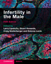 Infertility in the Male Infertility in the Male