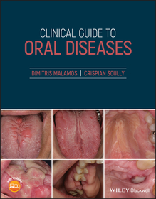 Clinical Guide to Oral Diseases Clinical Guide to Oral Diseases