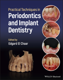 Practical Techniques in Periodontics and Implant Dentistry Practical Techniques in Periodontics and Implant Dentistry