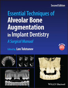 Essential Techniques of Alveolar Bone Augmentation in Implant Dentistry: A Surgical Manual Essential Techniques of Alveolar Bone Augmentation in Implant Dentistry: A Surgical Manual