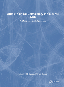 Atlas of Clinical Dermatology in Coloured Skin: A Morphological Approach Atlas of Clinical Dermatology in Coloured Skin: A Morphological Approach