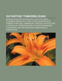 Gutartige Tumorbildung: Benigne Prostatahyperplasie, Warthin-Tumor, Pyogenes Granulom, Lipom, Uterus myomatosus, Fibröse Dysplasie, Hämangiom, Teratom, Histiozytose X, Synoviale Chondromatose, Hypophysenadenom, Plexuspapillom, Enchondrom, Pigmentnävus Gutartige Tumorbildung: Benigne Prostatahyperplasie, Warthin-Tumor, Pyogenes Granulom, Lipom, Uterus myomatosus, Fibröse Dysplasie, Hämangiom, Teratom, Histiozytose X, Synoviale Chondromatose, Hypophysenadenom, Plexuspapillom, Enchondrom, Pigmentnävus