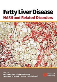 Fatty Liver Disease ? NASH and Related Disorders: NASH and Related Disorders