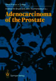 Adenocarcinoma of the Prostate Adenocarcinoma of the Prostate