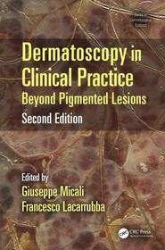 Dermatoscopy in Clinical Practice: Beyond Pigmented Lesions