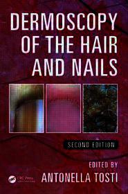 Dermoscopy of the Hair and Nails