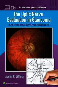 The Optic Nerve Evaluation in Glaucoma: An Interactive Workbook