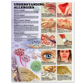 Understanding Allergies Anatomical Chart