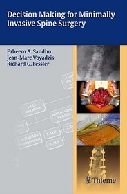 Decision Making for Minimally Invasive Spine Surgery