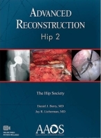 Advanced Reconstruction: Hip 2