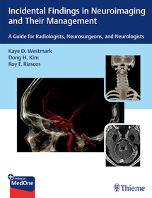 Incidental Findings in Neuroimaging and Their Management: A Guide for Radiologists, Neurosurgeons, and Neurologists