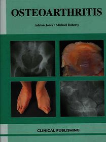 Oesteoarthritis: An Atlas of Investigation and Diagnosis