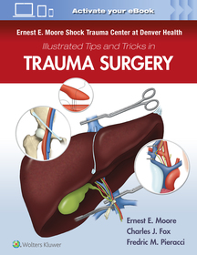 Ernest E. Moore Shock Trauma Center at Denver Health Illustrated Tips and Tricks in Trauma Surgery Ernest E. Moore Shock Trauma Center at Denver Health Illustrated Tips and Tricks in Trauma Surgery