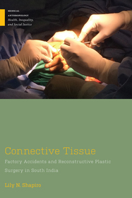 Connective Tissue: Factory Accidents and Reconstructive Plastic Surgery in South India Connective Tissue: Factory Accidents and Reconstructive Plastic Surgery in South India
