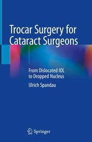 Trocar Surgery for Cataract Surgeons: From Dislocated IOL to Dropped Nucleus Trocar Surgery for Cataract Surgeons: From Dislocated IOL to Dropped Nucleus
