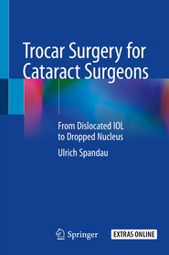 Trocar Surgery for Cataract Surgeons: From Dislocated IOL to Dropped Nucleus Trocar Surgery for Cataract Surgeons: From Dislocated IOL to Dropped Nucleus