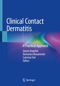 Clinical Contact Dermatitis: A Practical Approach