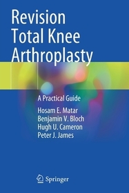 Revision Total Knee Arthroplasty: A Practical Guide