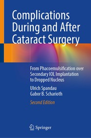 Complications During and After Cataract Surgery: From Phacoemulsification Over Secondary IOL Implantation to Dropped Nucleus Complications During and After Cataract Surgery: From Phacoemulsification Over Secondary IOL Implantation to Dropped Nucleus