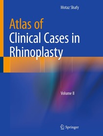 Atlas of Clinical Cases in Rhinoplasty: Volume II Atlas of Clinical Cases in Rhinoplasty: Volume II
