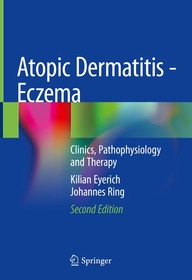 Atopic Dermatitis - Eczema: Clinics, Pathophysiology and Therapy Atopic Dermatitis - Eczema: Clinics, Pathophysiology and Therapy