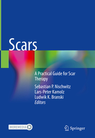 Scars: A Practical Guide for Scar Therapy Scars: A Practical Guide for Scar Therapy