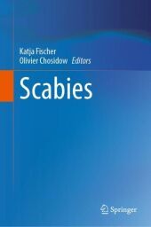 Scabies Scabies