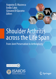 Shoulder Arthritis across the Life Span: From Joint Preservation to Arthroplasty Shoulder Arthritis across the Life Span: From Joint Preservation to Arthroplasty