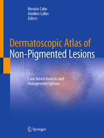 Dermatoscopic Atlas of Non-Pigmented Lesions: Case-based Analysis and Management Options Dermatoscopic Atlas of Non-Pigmented Lesions: Case-based Analysis and Management Options