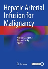 Hepatic Arterial Infusion for Malignancy