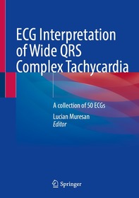 ECG Interpretation of Wide QRS Complex Tachycardia : A collection of 50 ECGs ECG Interpretation of Wide QRS Complex Tachycardia : A collection of 50 ECGs