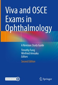 Viva and OSCE Exams in Ophthalmology: A Revision Study Guide