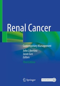 Renal Cancer: Contemporary Management Renal Cancer: Contemporary Management