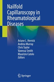 Nailfold Capillaroscopy in Rheumatological Diseases