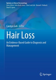 Hair Loss: An Evidence-Based Guide to Diagnosis and Management