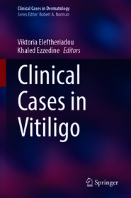 Clinical Cases in Vitiligo