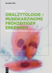 Oralzytologie - Mundkarzinome frühzeitiger erkennen: Praxiswissen zur Oralen Zytodiagnostik