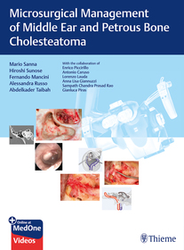 Microsurgical Management of Middle Ear and Petrous Bone Cholesteatoma