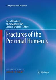 Fractures of the Proximal Humerus