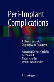 Peri-Implant Complications: A Clinical Guide to Diagnosis and Treatment