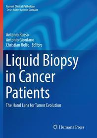 Liquid Biopsy in Cancer Patients: The Hand Lens for Tumor Evolution