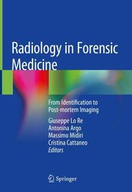 Radiology in Forensic Medicine: From Identification to Post-mortem Imaging