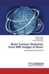 Brain Tumour Detection from MRI Images of Brain: Using Hybrid Genetic FCM