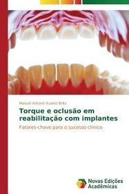 Torque e oclus?o em reabilitaç?o com implantes: Fatores-chave para o sucesso clínico