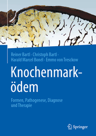 Knochenmarködem: Formen, Pathogenese, Diagnose und Therapie Knochenmarködem: Formen, Pathogenese, Diagnose und Therapie