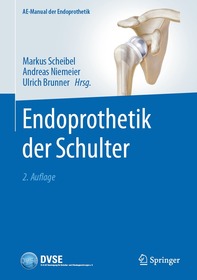 Endoprothetik der Schulter