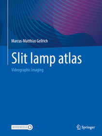 Slit lamp atlas: Videographic Imaging Slit lamp atlas: Videographic Imaging