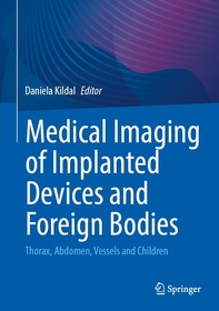 Medical Imaging of Implanted Devices and Foreign Bodies: Thorax, Abdomen, Vessels and Children Medical Imaging of Implanted Devices and Foreign Bodies: Thorax, Abdomen, Vessels and Children