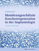 Membrangeschützte Knochenregeneration in der Implantologie Membrangeschützte Knochenregeneration in der Implantologie